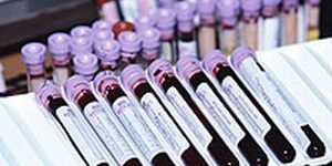 Examen de sangre para detectar cáncer cada vez más cerca